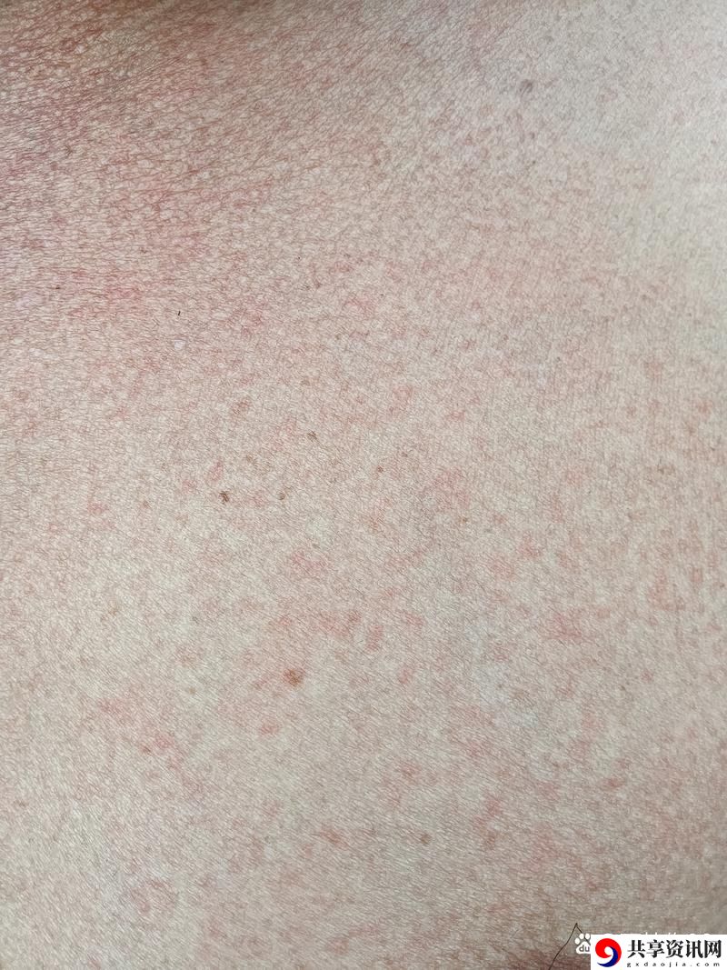  淑芬两腿间又痒又疼的原因，用户评论：