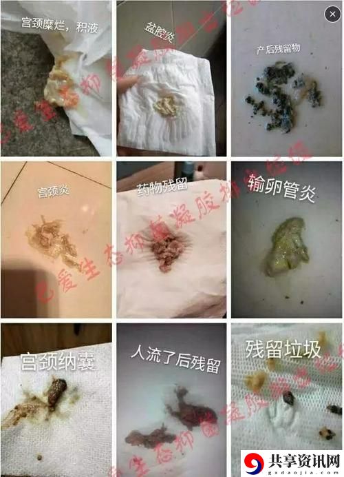 月月我这是帮你排阴毒，粉丝：真是为我们着想啊！